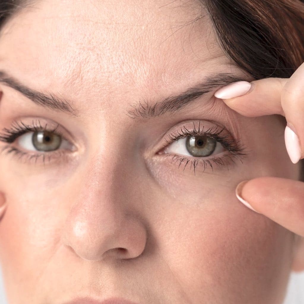 Billedet viser et close-up af en dames øjenomgivelser. Billedet er til en side omhandlende behandling af tunge øjenlåg.